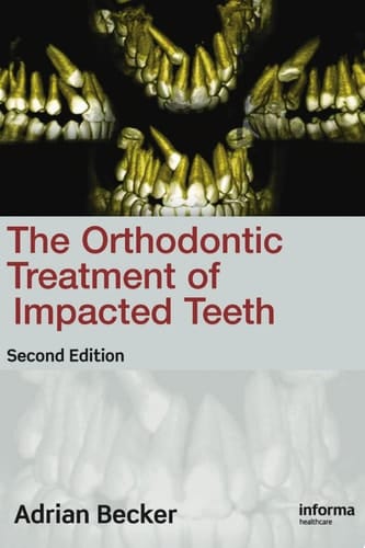 Orthodontic Treatment of Impacted Teeth Ed2