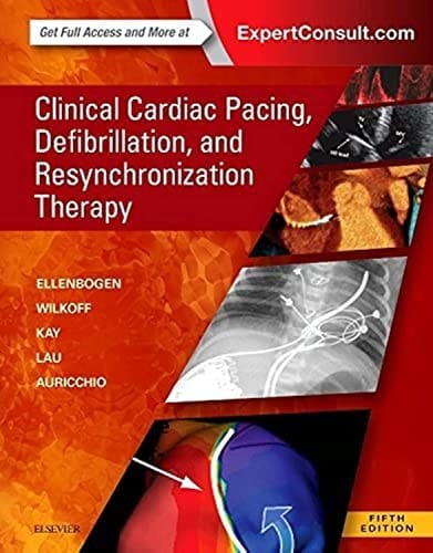 Clinical Cardiac Pacing, Defibrillation, and Resynchronization Therapy