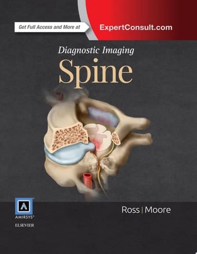 Diagnostic Imaging: Spine