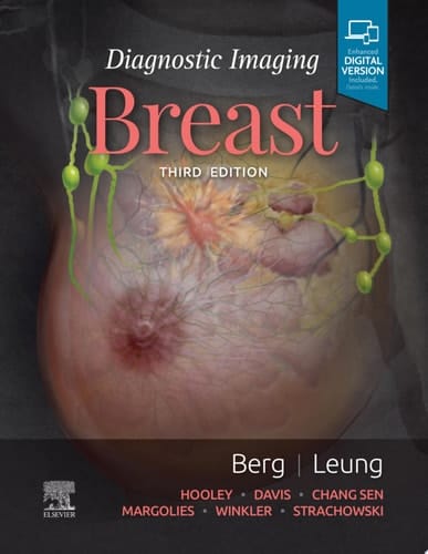 Diagnostic Imaging: Breast E-Book Diagnostic Imaging: Breast E-Book