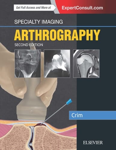 Specialty Imaging: Arthrography