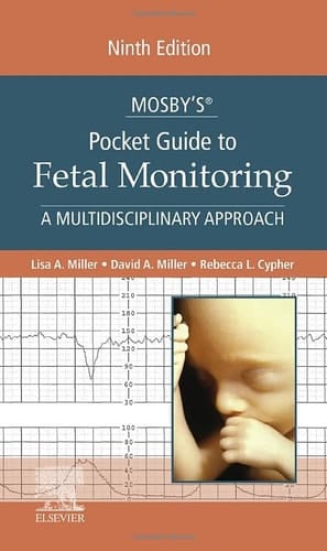 Mosby's® Pocket Guide to Fetal Monitoring