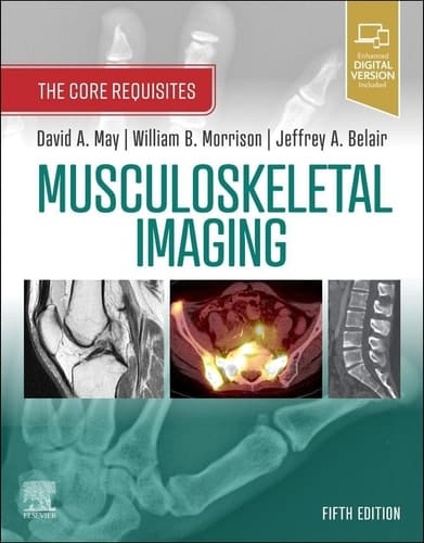 Musculoskeletal Imaging The Core Requisites
