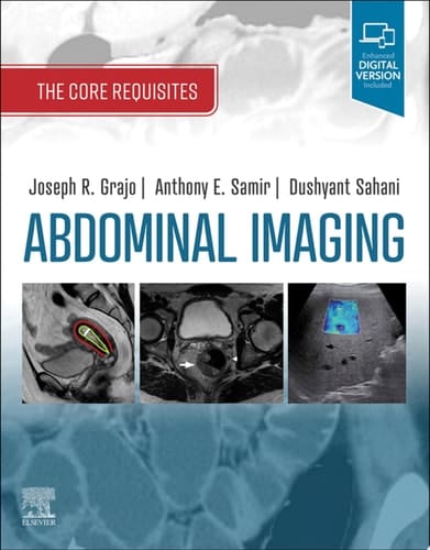 Abdominal Imaging E-Book The Core Requisites