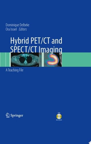 Hybrid PET/CT and SPECT/CT Imaging