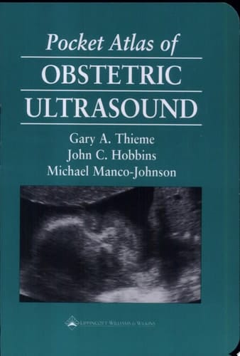 Pocket Atlas of Obstetric Ultrasound