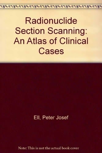 Radionuclide Section Scanning An Atlas of Clinical Practice