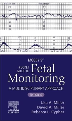 Mosby’s® Pocket Guide to Fetal Monitoring