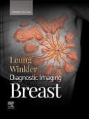 Diagnostic Imaging: Breast, E-Book