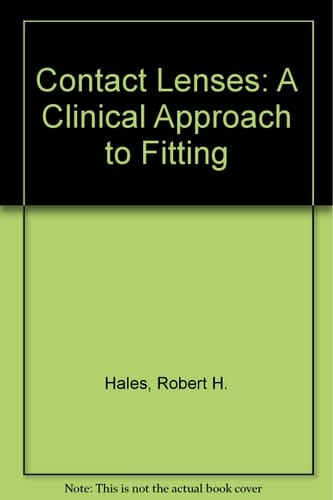 Contact Lenses A Clinical Approach to Fitting