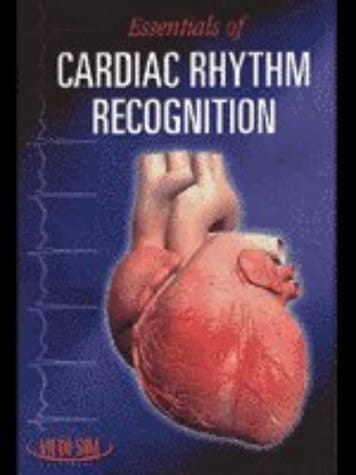 Essentials of Cardiac Rhythm Recognition
