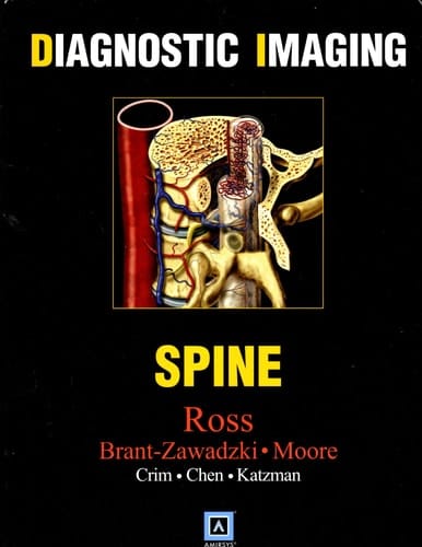 Diagnostic Imaging: Spine