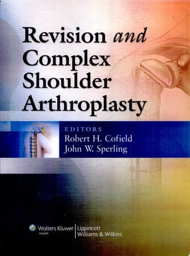 Revision and Complex Shoulder Arthroplasty