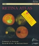 The Retina Atlas