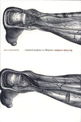 The Body Multiple Ontology in Medical Practice