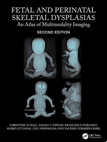 Fetal and Perinatal Skeletal Dysplasias