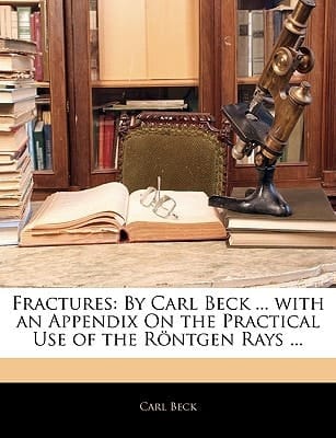 Fractures: By Carl Beck ... with an Appendix On the Practical Use of the Röntgen Rays ...