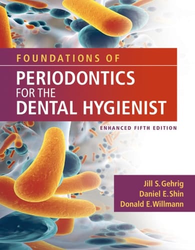 Foundations of Periodontics for the Dental Hygienist, Enhanced