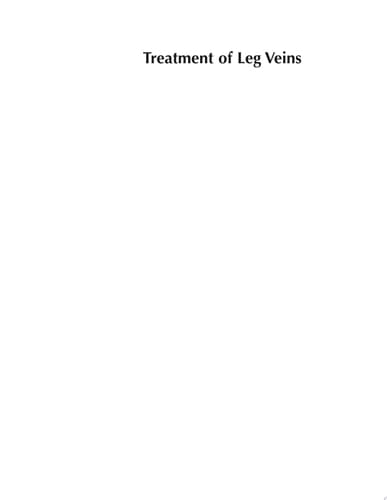 Treatment of Leg Veins