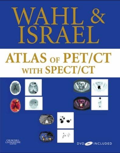 Atlas of PET/CT: with SPECT/CT