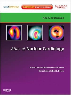 Atlas of Nuclear Cardiology: Imaging Companion to Braunwald's Heart Disease Expert Consult - Online and Print