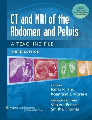 CT  MRI of the Abdomen and Pelvis