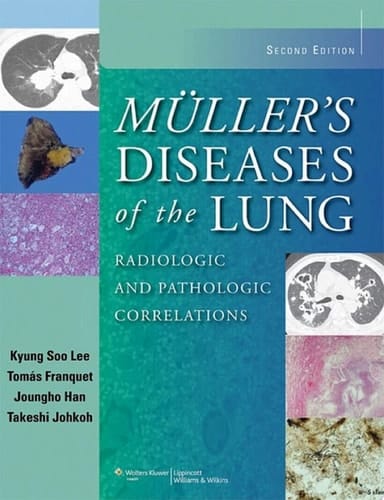 Muller's Diseases of the Lung Radiologic and Pathologic Correlations
