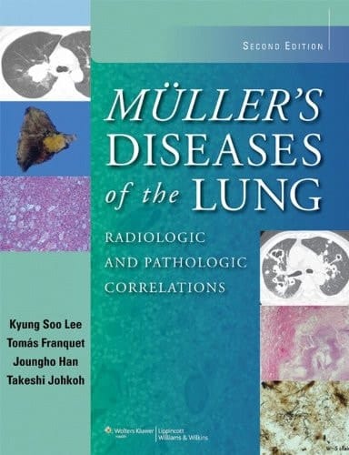 Muller's Diseases of the Lung: Radiologic and Pathologic Correlations