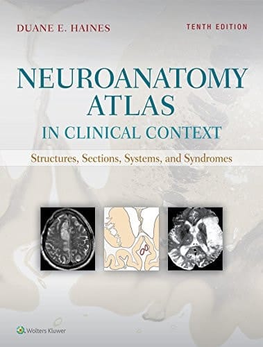 Neuroanatomy Atlas in Clinical Context Structures, Sections, Systems, and Syndromes
