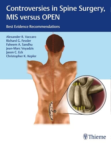 Controversies in Spine Surgery, MIS Versus OPEN Best Evidence Recommendations