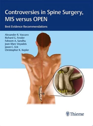 Controversies in Spine Surgery, MIS versus OPEN Best Evidence Recommendations
