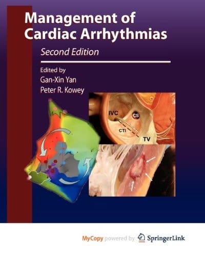 Management of Cardiac Arrhythmias
