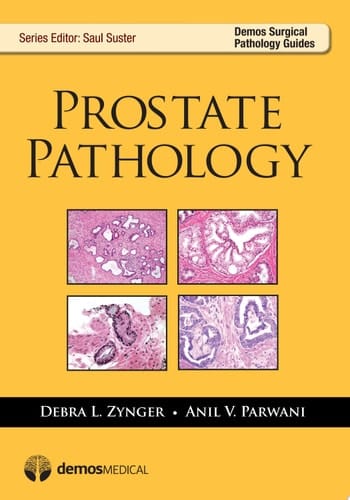 Prostate Pathology