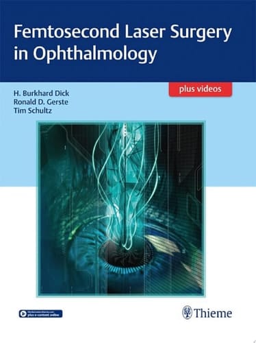 Femtosecond Laser Surgery in Ophthalmology