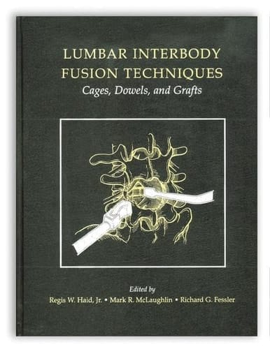 Lumbar Interbody Fusion Techniques: Cages, Dowels, and Grafts