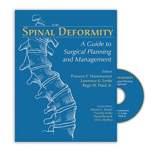 Spinal Deformity A Guide to Surgical Planning and Management