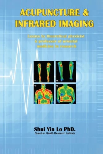 Acupuncture and Infrared Imaging: Essays by theoretical physicist & professor of oriental medicine in research