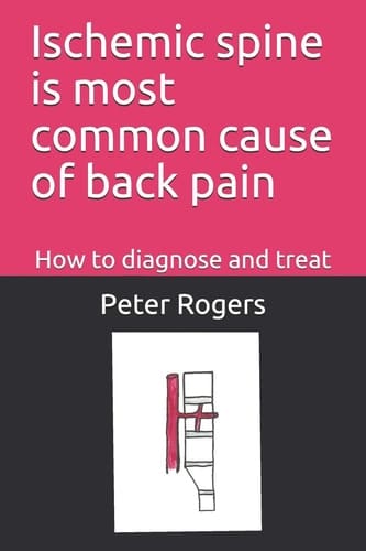 Ischemic Spine Is Most Common Cause of Back Pain How to Diagnose and Treat
