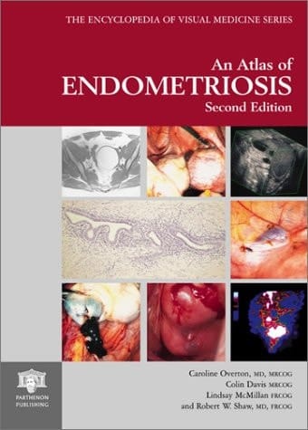 Atlas of Endometriosis