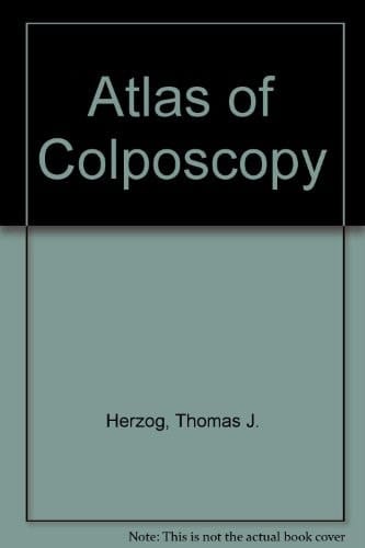 Atlas of Colposcopy