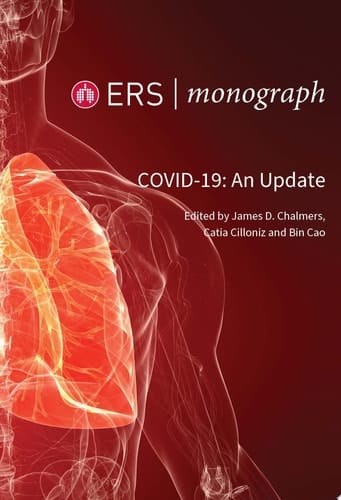COVID-19: An Update