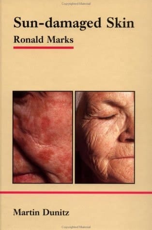 Sun-Damaged Skin: Pocketbook