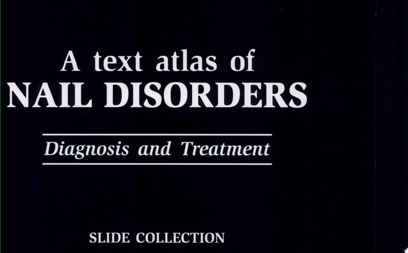 A Text Atlas of Nail Disorders: slide atlas