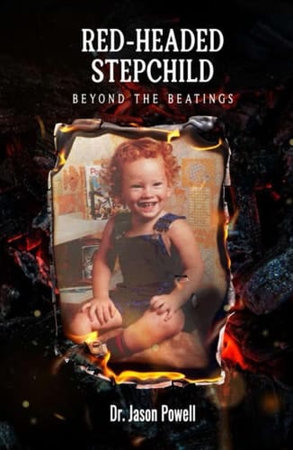 Red-Headed Stepchild Beyond the Beatings