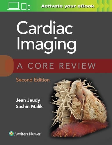 Cardiac Imaging A Core Review