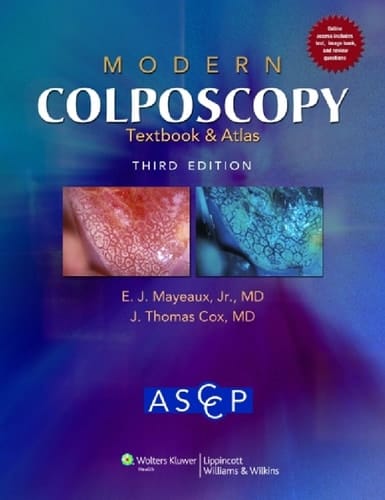 Modern Colposcopy Textbook and Atlas