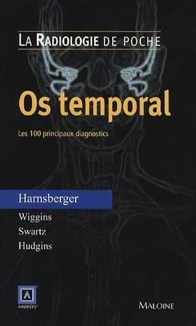 Os temporal les 100 principaux diagnostics