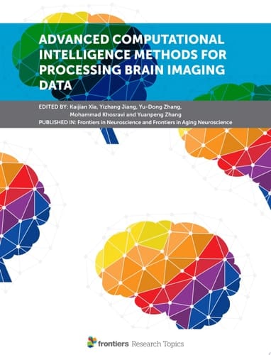 Advanced Computational Intelligence Methods for Processing Brain Imaging Data