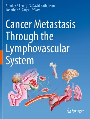 Cancer Metastasis Through the Lymphovascular System