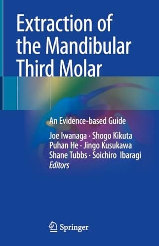 Extraction of the Mandibular Third Molar An Evidence-based Guide